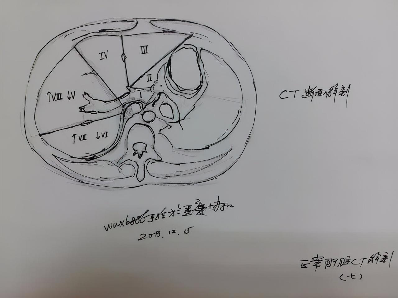 震惊！9岁男孩自学解剖，天赋异禀还是教育力量？